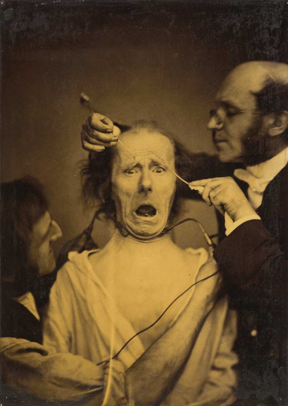 Guillaume-Benjamin-Amant-Duchenne-(de-Boulogne)-Terror-mixed-with-pain,-torture,-1854-1856_950-W
